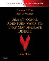 Atlas of Normal Roentgen Variants That May Simulate Disease E-Book: Atlas of Normal Roentgen Variants That May Simulate Disease E-Book (ePub eBook)
